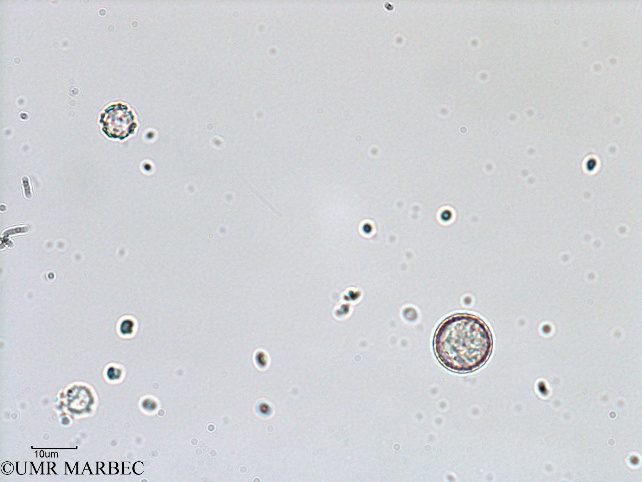 phyto/Bizerte/bizerte_bay/RISCO February 2015/Centrique spp 15-70µm (ancien Baie_T5-C2-Coccolitho spp-4).tif(copy).jpg
